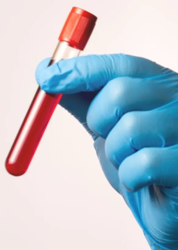 Közeli kép egy gyermek kezéről, melyen egy rózsaszín okosóra látható, sötét, márványos felületen fekve. Okosóra, gyerek okosóra, digitális eszköz, technológia, biztonság, követés, távfelügyelet, gyermekvédelem, viselhető technológia.